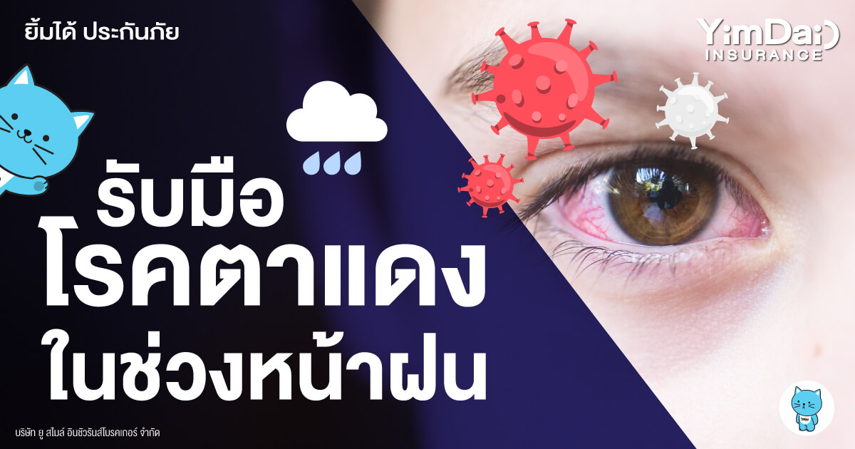หน้าฝน เตรียมรับมือโรคตาแดง!